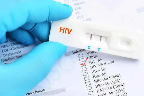 HIV-2.jpg